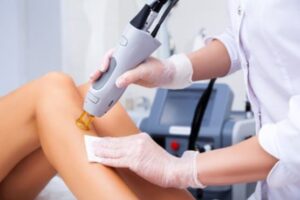 Laser Hair Removal Nashville