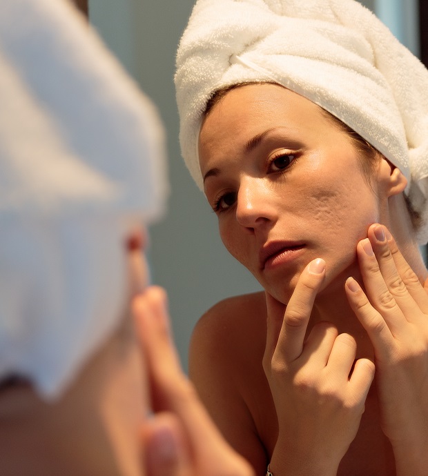 Acne Scarring Treatments Nashville, TN