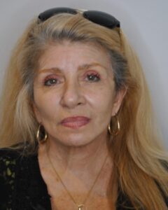 After Image: Facelift and Neck Lift