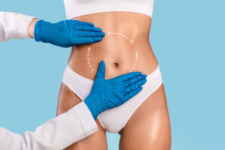 Renuvion skin tightening Nashville, TN.