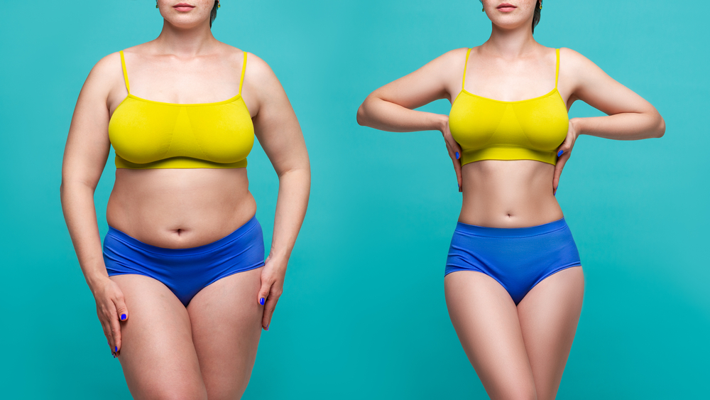 Woman's,Body,Before,And,After,Weight,Loss,On,Blue,Background,